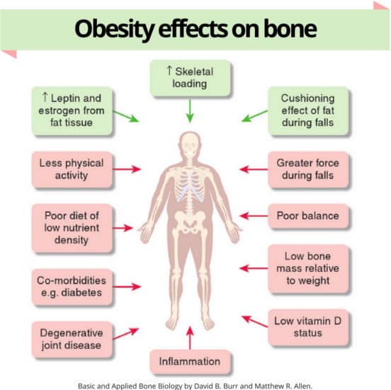 obesity effects on bones